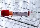 Vírus Nipah: o que se sabe sobre os casos detectados na Índia.